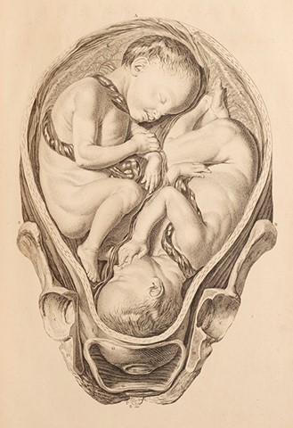 Example of a copper plate engraving from the 1754 first edition of William Smellie’s Sett of Anatomical Tables.